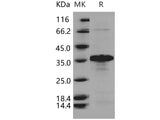 Recombinant Human BNIP3L Protein