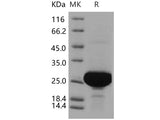 Recombinant Human PARK7/DJ-1 Protein (His Tag)