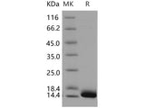 Recombinant Human CALML3 Protein (His Tag)