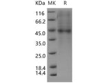 Recombinant Human PLA2G2D Protein (Fc Tag)