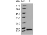 Recombinant Human PHPT1/PHP14 Protein (His Tag)