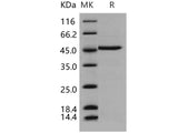 Recombinant Human DDOST/OST48 Protein