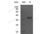 Recombinant Human LMAN2/VIP36 Protein (E.coli, His Tag)