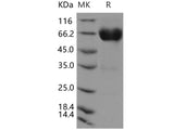 Recombinant Human CD300a/LMIR1 Protein (Fc Tag)