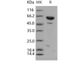 Recombinant Human DUSP14/MKP-6 Protein (His & MBP Tag)