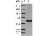 Recombinant Human RhoA Protein (His Tag)