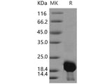 Recombinant Human Calmodulin 2/CALM2 Protein (His Tag)