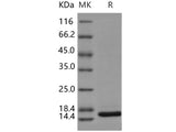 Recombinant Human DIM1/TXNL4A Protein (His Tag)