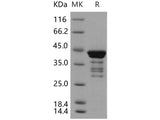 Recombinant Human C1D Protein (GST Tag)