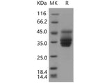 Recombinant Human IFITM3 Protein (Fc Tag)