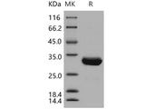 Recombinant Human SCGN/Secretagogin Protein (E.coli, His Tag)