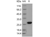 Recombinant Human AK4/AK3L1 Protein