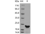 Recombinant Human N6AMT1/HEMK2 Protein (His Tag)