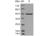 Recombinant Human PDK-1 Protein (His Tag)