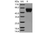 Recombinant Human MICA Protein (His Tag)