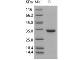 Recombinant Human Carbonic Anhydrase 5B/CA5B Protein (His Tag)(Active)