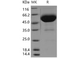 Recombinant Human CD47 Protein (Fc Tag)(Active)