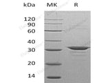 Recombinant Human CLIC4 Protein (His Tag)