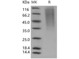 Recombinant Human CD164/Endolyn Protein (His Tag)