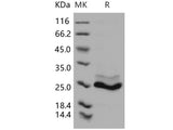 Recombinant Human K-Ras/K-Ras Protein (His Tag)