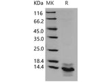 Recombinant Human S100A14/S114 Protein (His Tag)