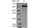 Recombinant Human SIGLEC6/CD327 Protein (Fc Tag)