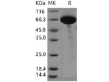 Recombinant Human COL9A1 Protein (Fc Tag)