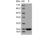 Recombinant Human PDZD11/PDZK11/PISP Protein (His Tag)