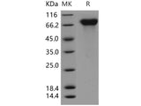 Recombinant Human PROS1/Protein S Protein (His Tag)