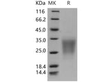 Recombinant Human SIGIRR/TIR8 Protein (His Tag)