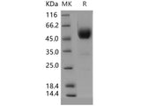 Recombinant Human SIGIRR/TIR8 Protein (Fc Tag)