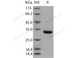 Recombinant Human Carbonic Anhydrase 7/CA7 Protein (His Tag)(Active)