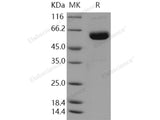 Recombinant Human ULBP2/N2DL-2 Protein (Fc Tag)