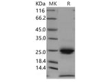 Recombinant Human Kallikrein 6/KLK6 Protein (His Tag)(Active)