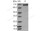 Recombinant Human STK23/MSSK1/SRPK3 Protein (His & GST Tag)