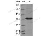 Recombinant Human PCNA Protein (His Tag)