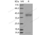 Recombinant Human Pancreasin/Marapsin/PRSS27 Protein (His Tag)(Active)