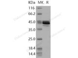 Recombinant Human Fumarase/FH Protein (His Tag)(Active)