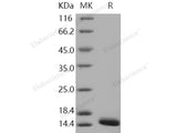 Recombinant Human FABP4/A-FABP Protein (29 Ala/Thr, His Tag)