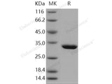 Recombinant Human Purine nucleoside phosphorylase/PNP Protein (His Tag)