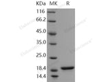 Recombinant Human Alpha-Synuclein/SNCA Protein