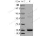 Recombinant Human Transthyretin/TTR Protein (His Tag)(Active)