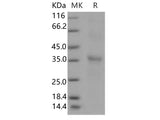 Recombinant Human RGMA Protein (HEK293 Cells, His Tag)