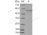 Recombinant Human Catalase/CAT Protein (His Tag)