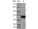 Recombinant Human BCL6/B-cell CLL lymphoma 6 Protein (aa 1-150, His & Trx Tag)