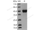 Recombinant Human PTX3/Pentraxin 3/TSG-14 Protein (His Tag)