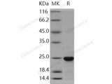 Recombinant Human NRAS Protein (His Tag)