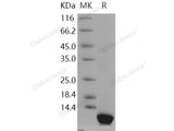 Recombinant Human Pepsinogen C/PGC Protein (E.coli, His Tag)