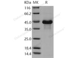 Recombinant Human VWC2/Brorin Protein (His Tag)