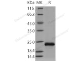 Recombinant Human HRAS/GTPase Hras Protein (His Tag)